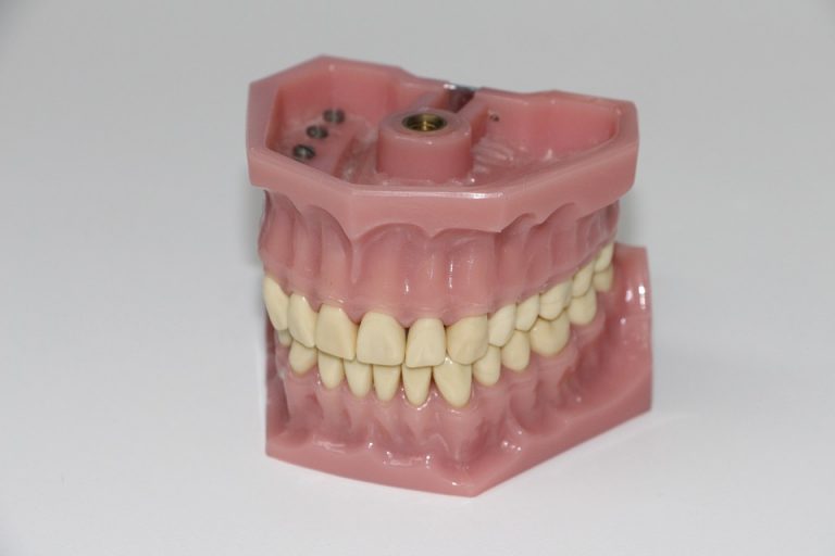 Zirconia, un nuevo material para implantes dentales