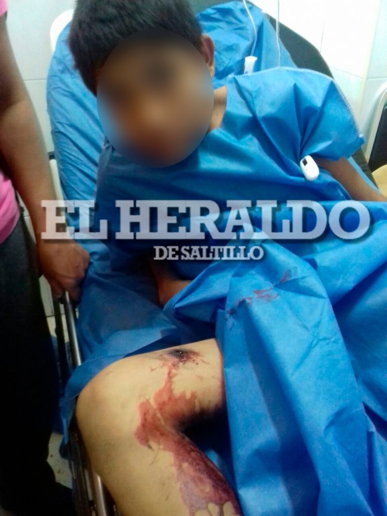 Niño que jugaba con pistola se da un tiro y acaba hospitalizado