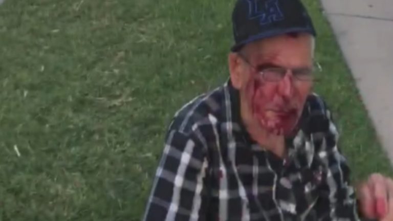 Donan más de 200 mil dólares para anciano mexicano golpeado en EU