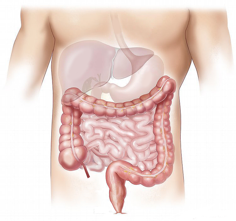 ¿Te sientes deprimido? Podrías afectar a tu intestino