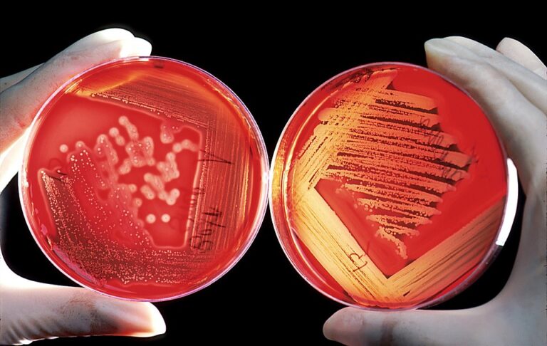 Buscan investigadores inhibir resistencia de microorganismos a antibióticos