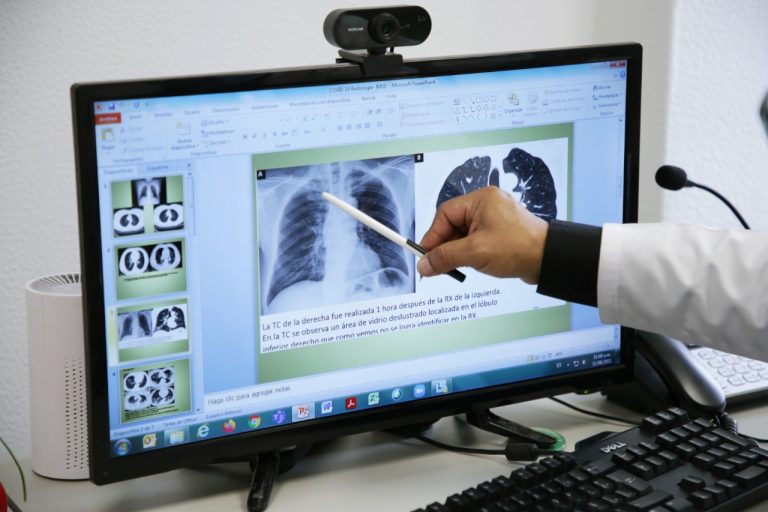 Atiende IMSS daño pulmonar y dificultad respiratoria causadas por COVID-19