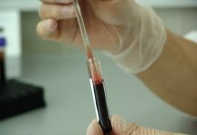 En 2025, más de un millón de personas adquirieron el VIH y 570 mil murieron por enfermedades relacionadas con el sida