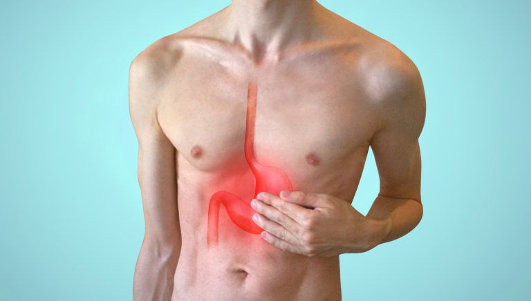 Gastritis: 5 alimentos que debes evitar si tienes este padecimiento