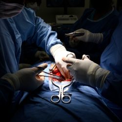 En 2021 IMSS realizó mil 791 trasplantes de órganos y tejidos, y aumentó su productividad en 212 por ciento