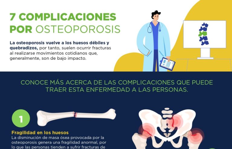 7 complicaciones de la osteoporosis