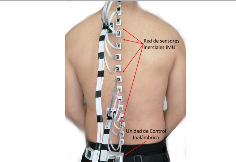 Diseña la UNAM sistema único en el mundo para monitorear movimiento de columna vertebral