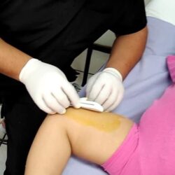 Ofrece Salud Coahuila 14 métodos anticonceptivos de manera gratuita