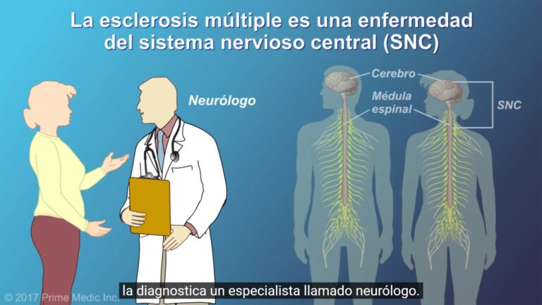 La esclerosis múltiple es más común en jóvenes adultos y mujeres