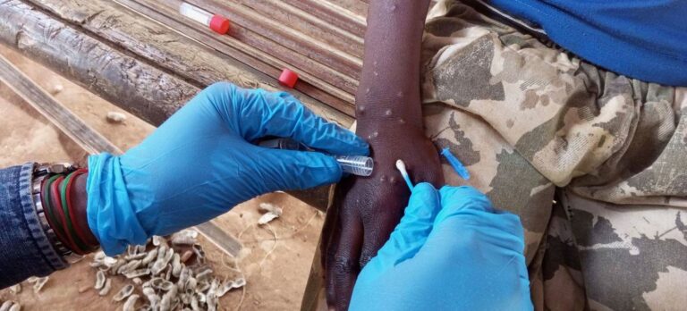 Mpox: Lo que hay que saber sobre esta emergencia mundial de salud pública