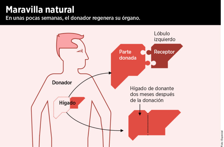 Trasplante de hígado: una oportunidad real