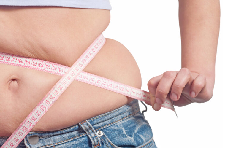¿Cómo deshacerse de la barriga colgante sin cirugía?