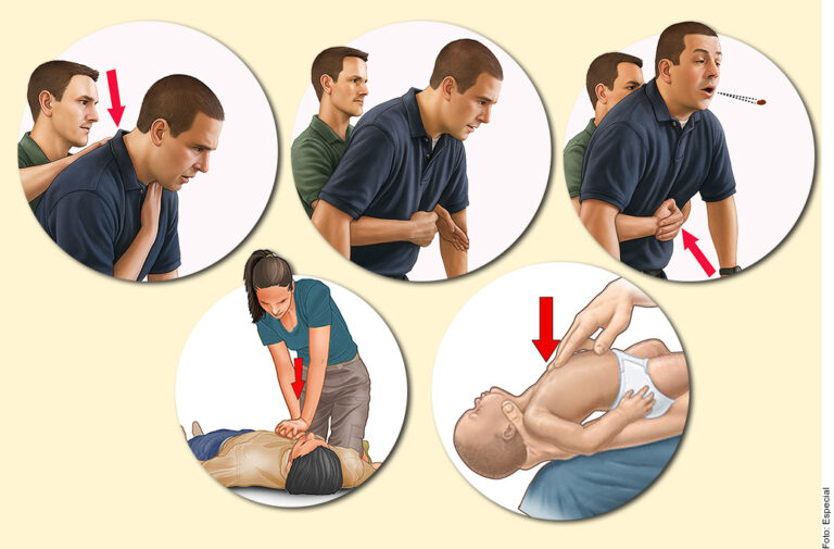 Estas son maniobras que salvan vidas