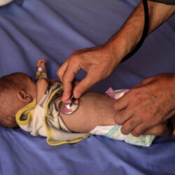 MEDIO ORIENTE-CIUDAD DE GAZA-HAMBRE-DESNUTRICION