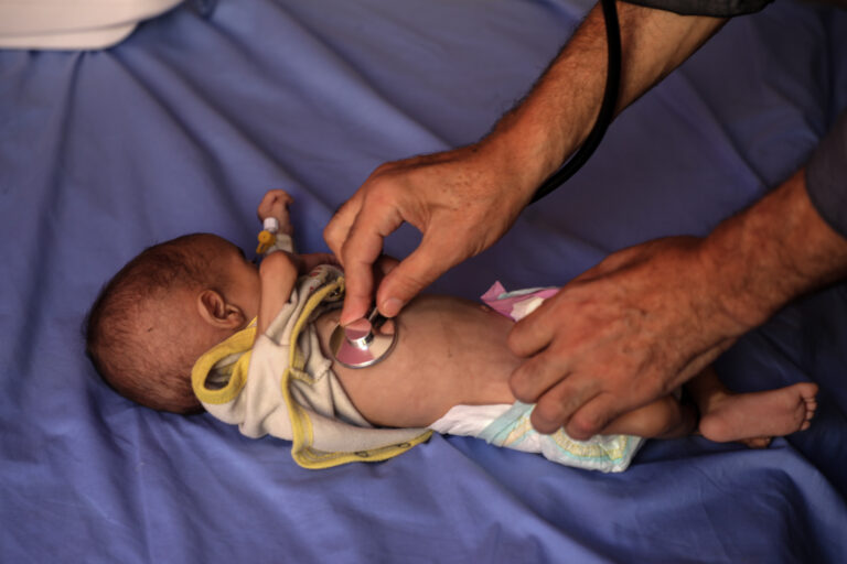 Uno de cada cinco niños en la ciudad de Gaza está gravemente desnutrido