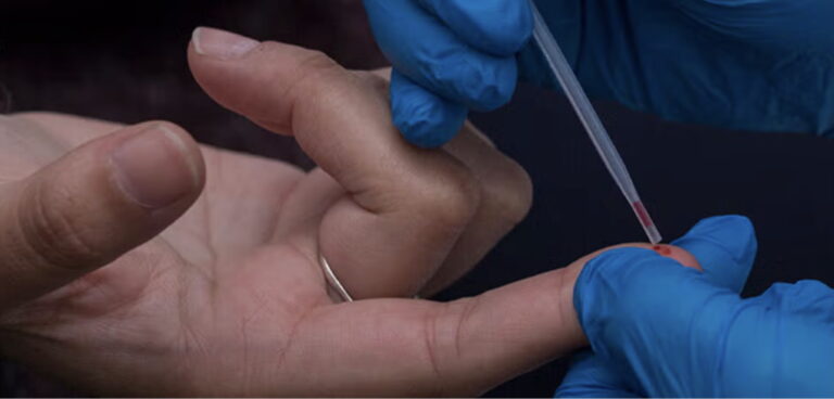 Preocupa incremento en casos de VIH en Coahuila