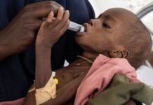 El hambre en el mundo se concentra en solo diez países