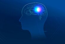 Comparten ‘el ABC de un evento cerebro vascular’