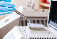 Por primera vez: hombre con VIH deja medicamentos tras trasplante de células madre de su hermano