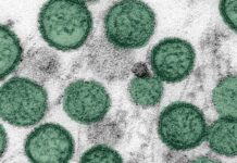 Brote de Hantavirus en crucero: otro pasajero contrae la enfermedad