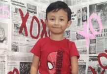 Piden apoyo para que Edgar pueda acceder a cirugía que mejorará su calidad de vida
