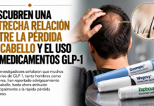 Descubren una estrecha relación entre la pérdida de cabello y el uso de medicamentos GLP-1