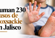 Suman 230 casos de Coxsackie en Jalisco